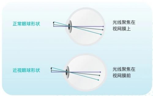 镜片密度是越大越好吗